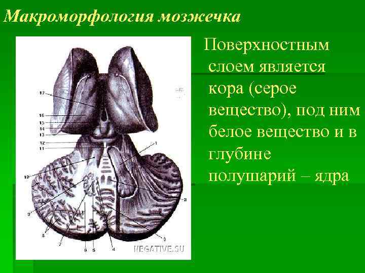 Макроморфология мозжечка Поверхностным слоем является кора (серое вещество), под ним белое вещество и в