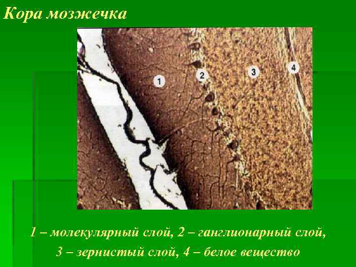 Кора мозжечка 1 – молекулярный слой, 2 – ганглионарный слой, 3 – зернистый слой,