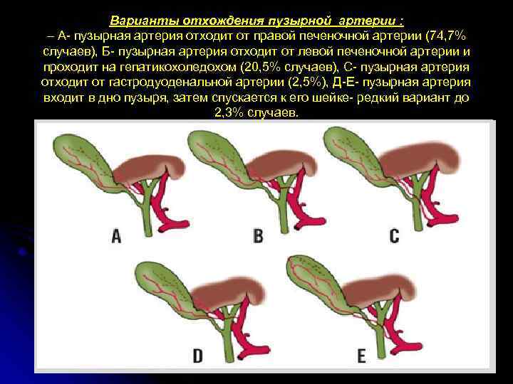 Варианты отхождения пузырной артерии : – А- пузырная артерия отходит от правой печеночной артерии