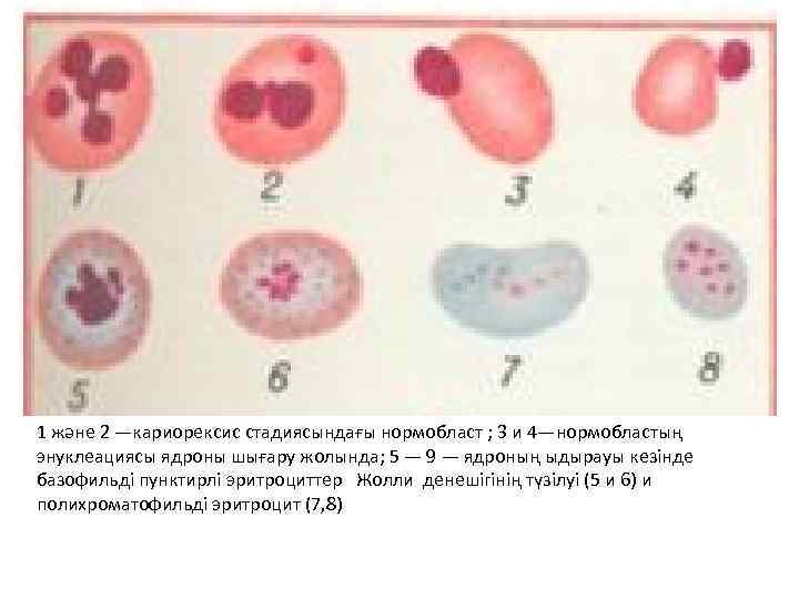1 және 2 —кариорексис стадиясындағы нормобласт ; 3 и 4—нормобластың энуклеациясы ядроны шығару жолында;