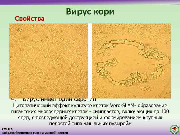 Вирус кори рисунок микробиология