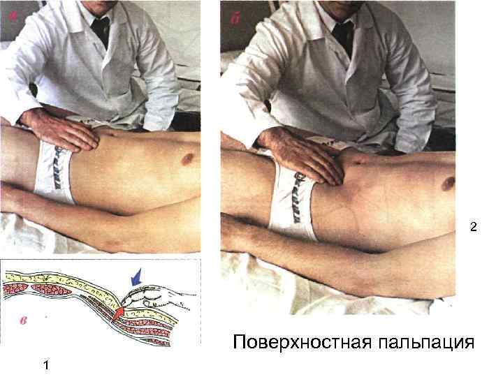 2 Поверхностная пальпация 1 