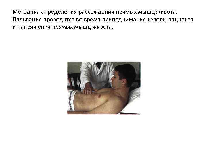 Методика определения расхождения прямых мышц живота. Пальпация проводится во время приподнимания головы пациента и