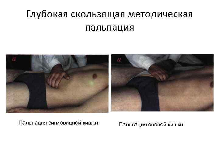 Глубокая скользящая методическая пальпация Пальпация сигмовидной кишки Пальпация слепой кишки 