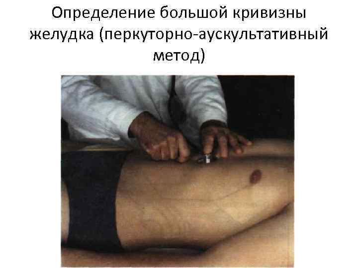 Определение большой кривизны желудка (перкуторно аускультативный метод) 