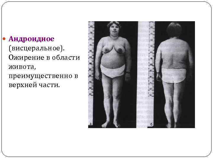  Андроидное (висцеральное). Ожирение в области живота, преимущественно в верхней части. 
