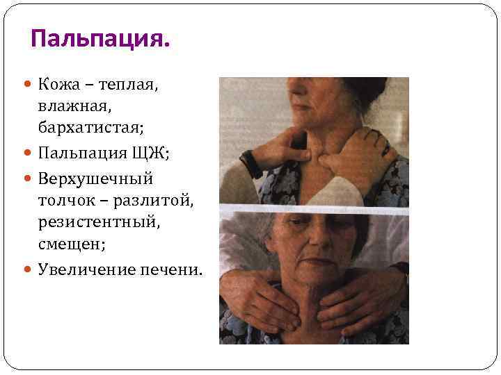 Пальпация. Кожа – теплая, влажная, бархатистая; Пальпация ЩЖ; Верхушечный толчок – разлитой, резистентный, смещен;