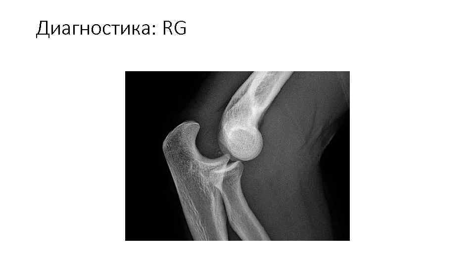 Диагностика: RG 