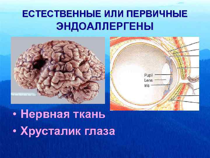ЕСТЕСТВЕННЫЕ ИЛИ ПЕРВИЧНЫЕ ЭНДОАЛЛЕРГЕНЫ • Нервная ткань • Хрусталик глаза 