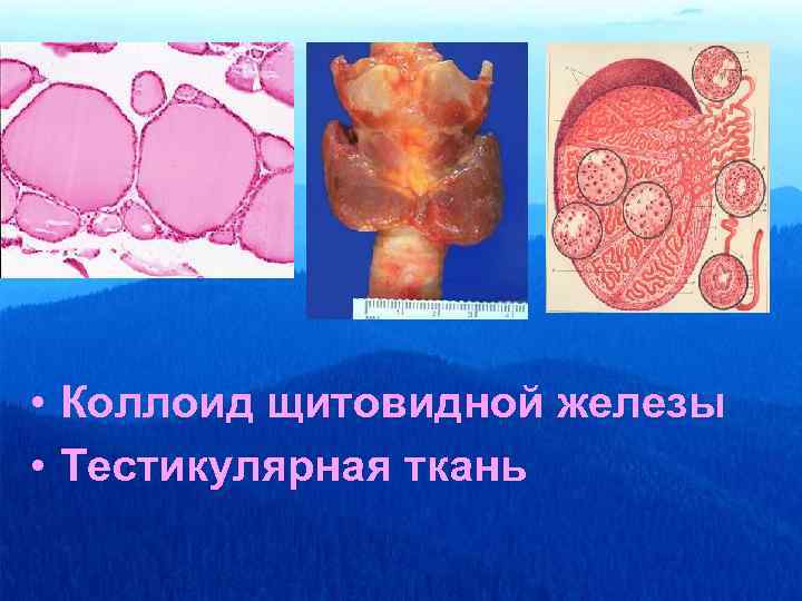  • Коллоид щитовидной железы • Тестикулярная ткань 