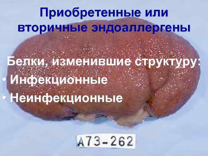Приобретенные или вторичные эндоаллергены Белки, изменившие структуру: • Инфекционные • Неинфекционные 