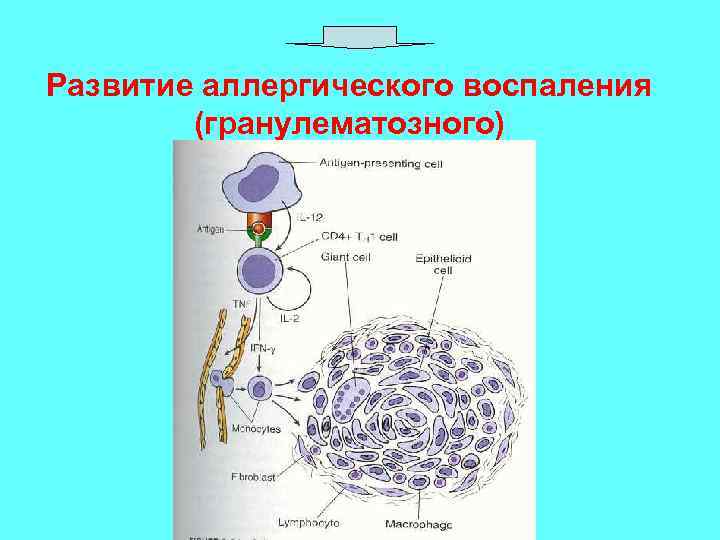 Развитие аллергического воспаления (гранулематозного) 