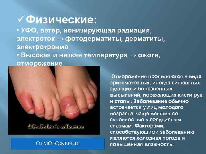 üФизические: • УФО, ветер, ионизирующая радиация, электроток → фотодерматиты, электротравма • Высокая и низкая