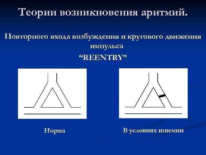 Теории возникновения аритмий. Повторного входа возбуждения и кругового движения импульса “REENTRY” Норма В условиях