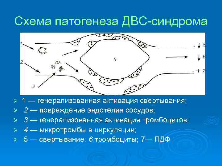 Схема патогенеза ДВС-синдрома Ø Ø Ø 1 — генерализованная активация свертывания; 2 — повреждение