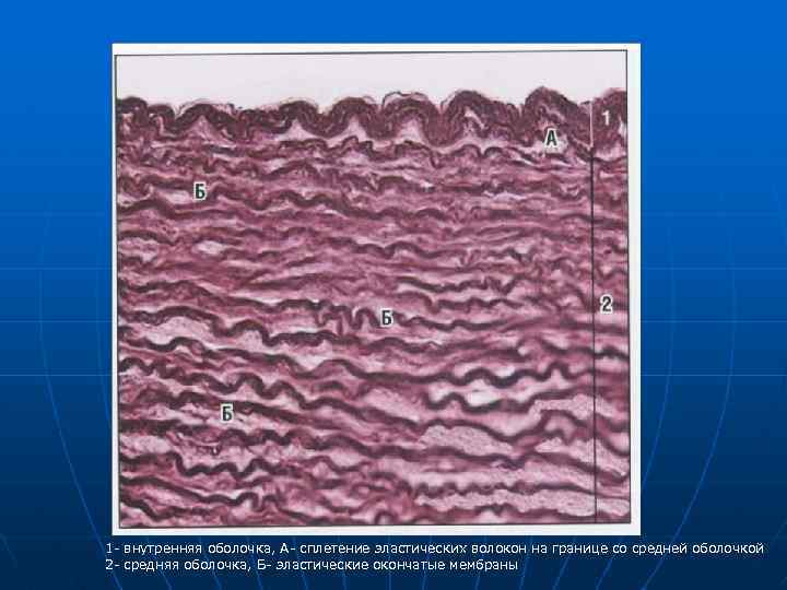 1 - внутренняя оболочка, А- сплетение эластических волокон на границе со средней оболочкой 2