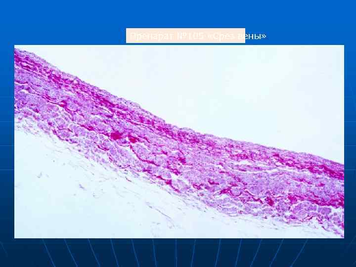 Препарат № 105 «Срез вены» 