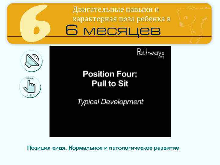 Позиция сидя. Нормальное и патологическое развитие. 