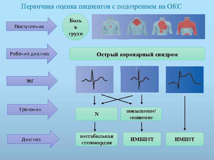 Первичная оценка пациентов с подозрением на ОКС Поступление Рабочий диагноз Боль в груди Острый