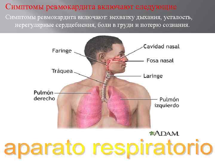 Симптомы ревмокардита включают следующие Симптомы ревмокардита включают: нехватку дыхания, усталость, нерегулярные сердцебиения, боли в