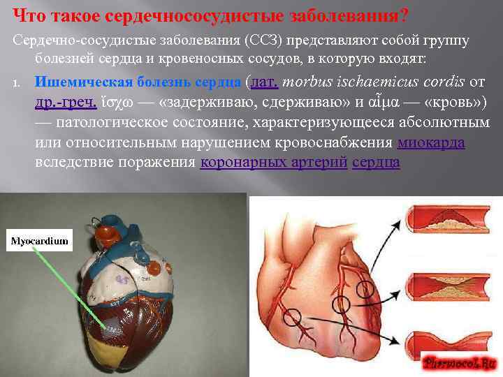 Что такое сердечнососудистые заболевания? Сердечно-сосудистые заболевания (ССЗ) представляют собой группу болезней сердца и кровеносных