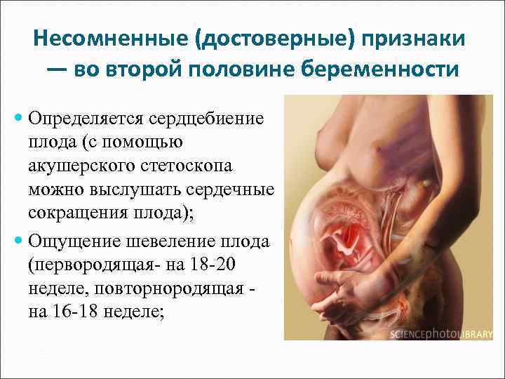 Несомненные (достоверные) признаки — во второй половине беременности Определяется сердцебиение плода (с помощью акушерского