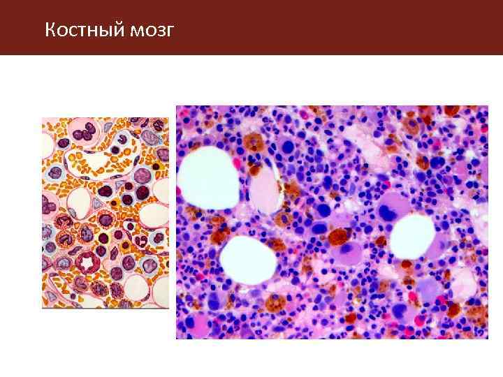 Костный мозг 