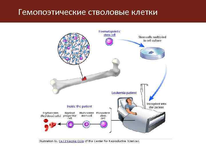 Гемопоэтические стволовые клетки 