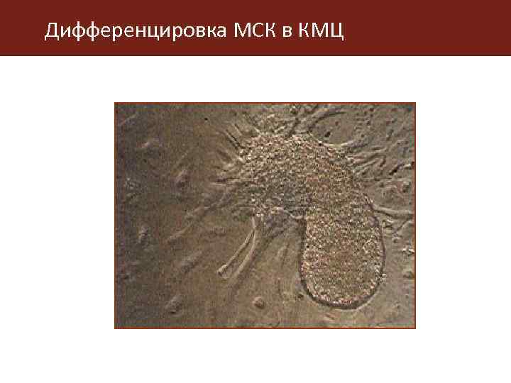 Дифференцировка МСК в КМЦ 