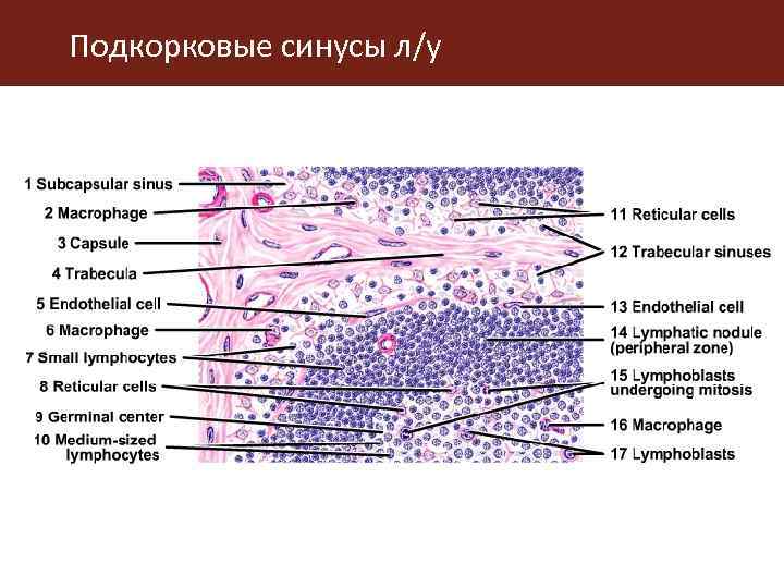Подкорковые синусы л/у 
