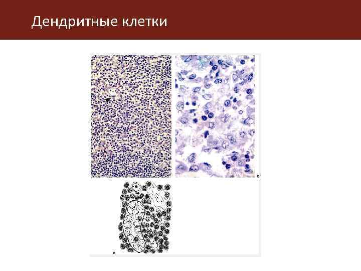 Дендритные клетки 