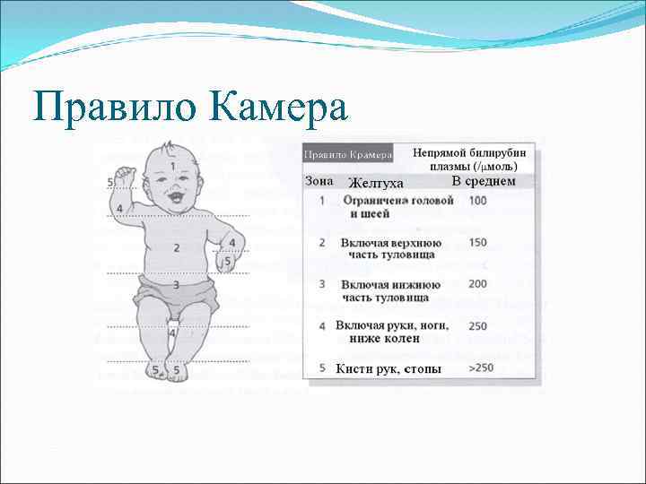 Правило Камера 