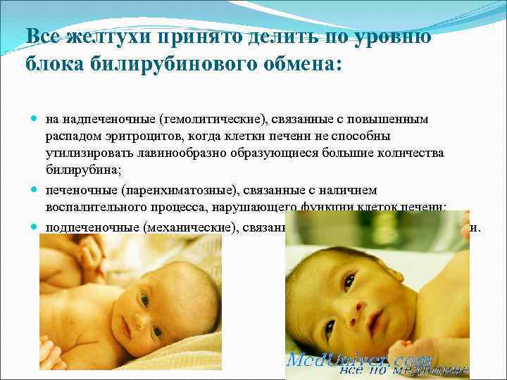 Все желтухи принято делить по уровню блока билирубинового обмена: на надпеченочные (гемолитические), связанные с