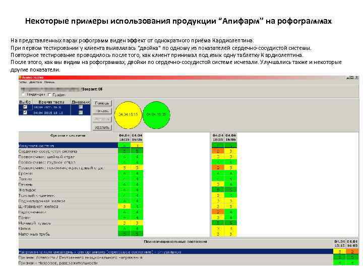 Некоторые примеры использования продукции “Апифарм” на рофограммах На представленных парах рофограмм виден эффект от