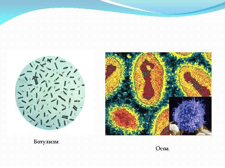 Ботулизм Оспа 