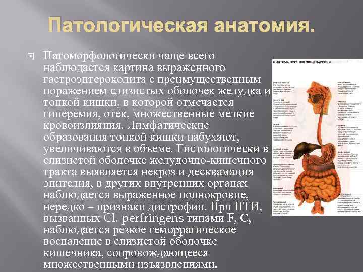 Патологическая анатомия. Патоморфологически чаще всего наблюдается картина выраженного гастроэнтероколита с преимущественным поражением слизистых оболочек