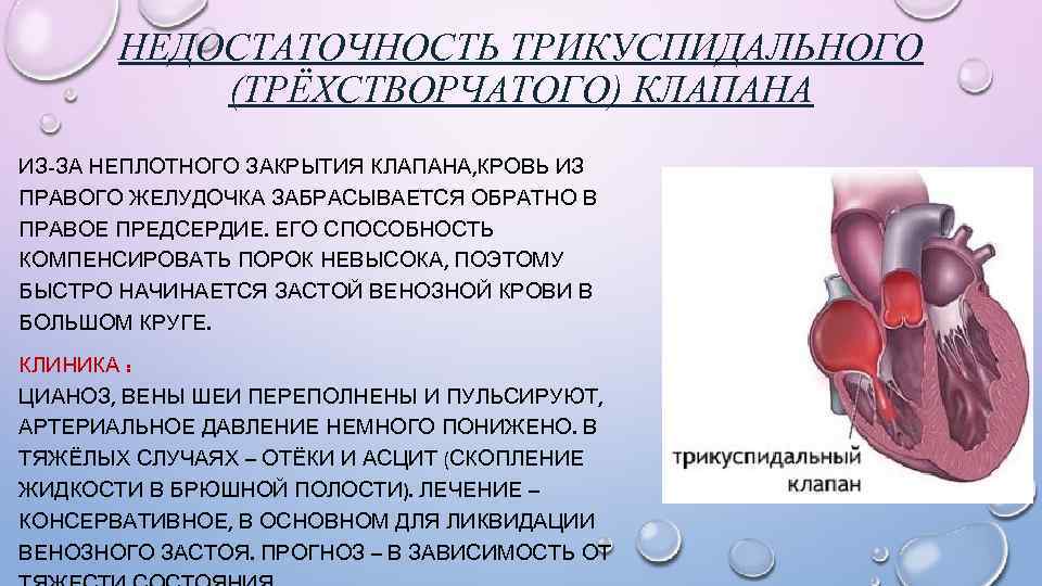 НЕДОСТАТОЧНОСТЬ ТРИКУСПИДАЛЬНОГО (ТРЁХСТВОРЧАТОГО) КЛАПАНА ИЗ-ЗА НЕПЛОТНОГО ЗАКРЫТИЯ КЛАПАНА, КРОВЬ ИЗ ПРАВОГО ЖЕЛУДОЧКА ЗАБРАСЫВАЕТСЯ ОБРАТНО