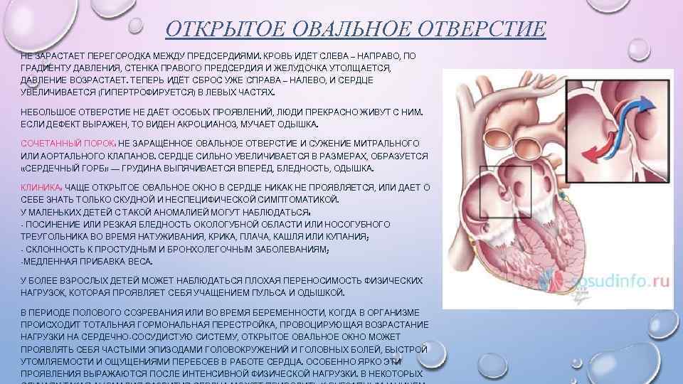 ОТКРЫТОЕ ОВАЛЬНОЕ ОТВЕРСТИЕ НЕ ЗАРАСТАЕТ ПЕРЕГОРОДКА МЕЖДУ ПРЕДСЕРДИЯМИ. КРОВЬ ИДЁТ СЛЕВА – НАПРАВО, ПО