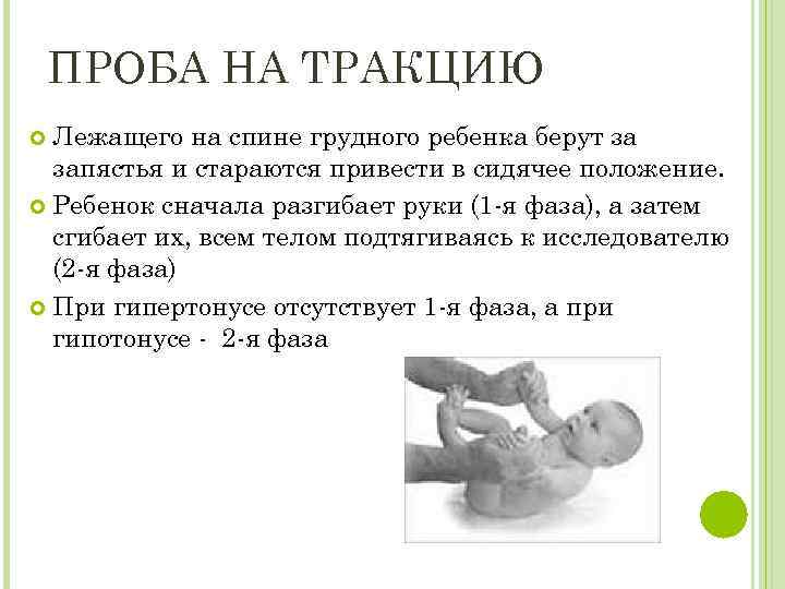 ПРОБА НА ТРАКЦИЮ Лежащего на спине грудного ребенка берут за запястья и стараются привести