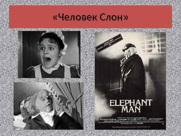  «Человек Слон» 