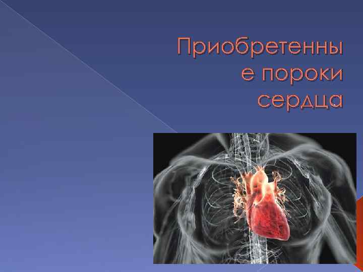 Приобретенные пороки сердца. Пороки сердца презентация. Многоклапанные пороки сердца. Презентация по теме порок сердца. Приобретенные пороки сердца ppt.