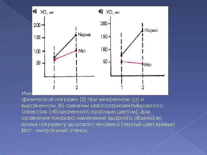 Изменение ударного объема (YO)в покое (1) и после физической нагрузки (2) при умеренном (а)