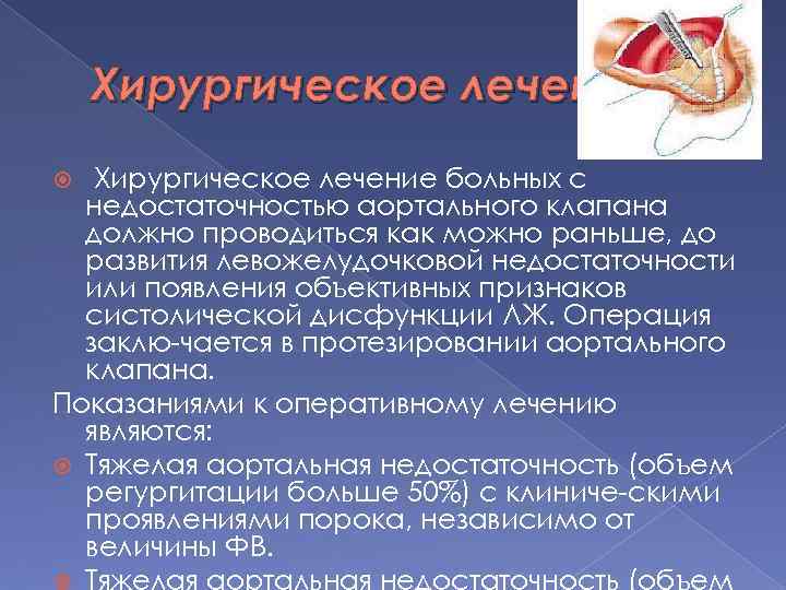 Хирургическое лечение больных с недостаточностью аортального клапана должно проводиться как можно раньше, до развития