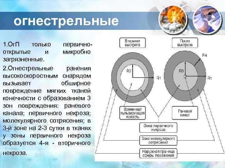 Схема раневого канала