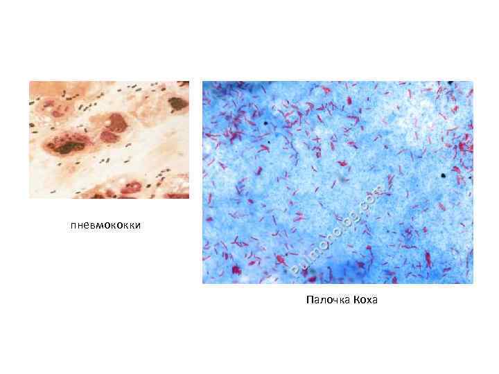 пневмококки Палочка Коха 