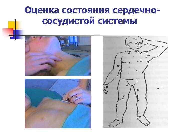 Оценка состояния сердечнососудистой системы 