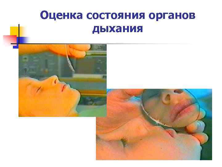 Оценка состояния органов дыхания 