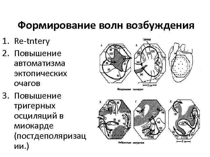 Формирование волн возбуждения 1. Re-tntery 2. Повышение автоматизма эктопических очагов 3. Повышение тригерных осциляций