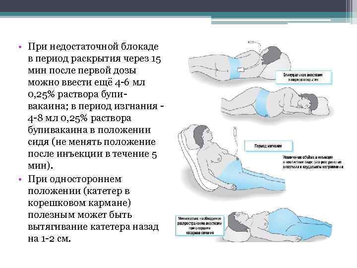  • При недостаточной блокаде в период раскрытия через 15 мин после первой дозы