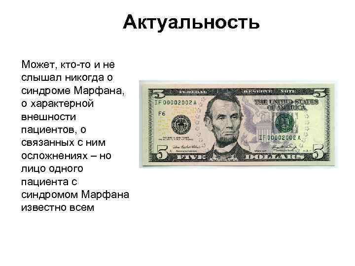 Актуальность Может, кто-то и не слышал никогда о синдроме Марфана, о характерной внешности пациентов,